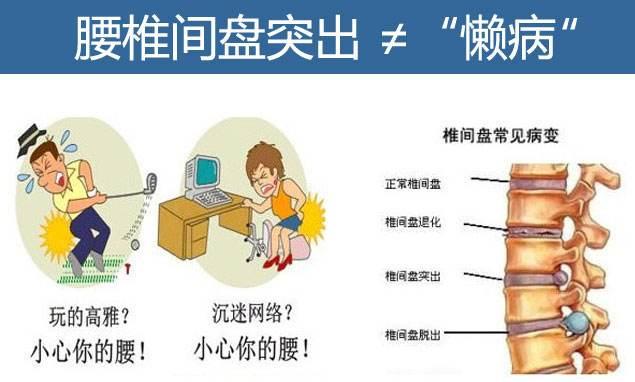 “十人九腰痛”腰椎病缠身好多年,中医对症施治是关键!